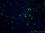 vwf Antibody in Immunohistochemistry (PFA fixed) (IHC (PFA))