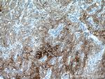 Cytokeratin 13 Antibody in Immunohistochemistry (Paraffin) (IHC (P))