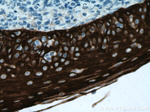 Cytokeratin 13 Antibody in Immunohistochemistry (Paraffin) (IHC (P))