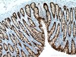 Galectin-4 Antibody in Immunohistochemistry (Paraffin) (IHC (P))