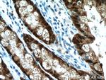 Galectin-4 Antibody in Immunohistochemistry (Paraffin) (IHC (P))