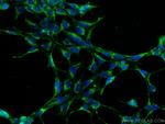 RAB3GAP1 Antibody in Immunocytochemistry (ICC/IF)