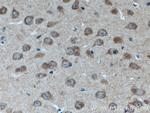 RAB3GAP1 Antibody in Immunohistochemistry (Paraffin) (IHC (P))