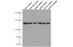 RAB3GAP1 Antibody in Western Blot (WB)