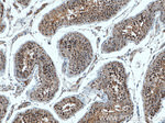 RAB3GAP1 Antibody in Immunohistochemistry (Paraffin) (IHC (P))