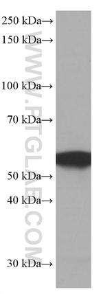 FKBP8 Antibody in Western Blot (WB)