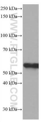 FKBP8 Antibody in Western Blot (WB)