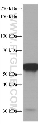 FKBP8 Antibody in Western Blot (WB)