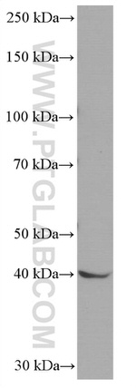 NEUROD1 Antibody in Western Blot (WB)