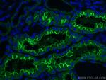 ACE2 Antibody in Immunohistochemistry (PFA fixed) (IHC (PFA))