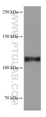 ACE2 Antibody in Western Blot (WB)