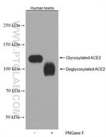 ACE2 Antibody in Western Blot (WB)