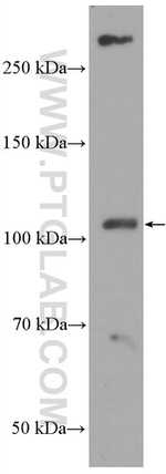 ACE2 Antibody in Western Blot (WB)