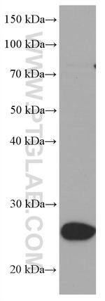 UCP2 Antibody in Western Blot (WB)