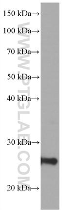 UCP2 Antibody in Western Blot (WB)