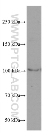 LIG4 Antibody in Western Blot (WB)