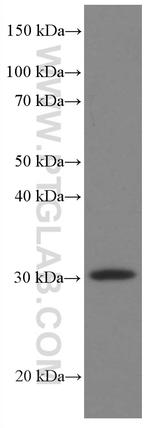 MTAP Antibody in Western Blot (WB)