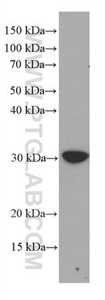 MTAP Antibody in Western Blot (WB)