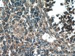 STRAP Antibody in Immunohistochemistry (Paraffin) (IHC (P))