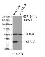 STRAP Antibody in Western Blot (WB)