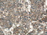 TPT1 Antibody in Immunohistochemistry (Paraffin) (IHC (P))