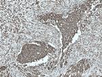 GSTP1 Antibody in Immunohistochemistry (Paraffin) (IHC (P))