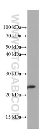 GSTP1 Antibody in Western Blot (WB)