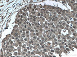 GSTP1 Antibody in Immunohistochemistry (Paraffin) (IHC (P))