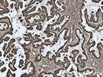 GSTP1 Antibody in Immunohistochemistry (Paraffin) (IHC (P))