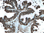 GSTP1 Antibody in Immunohistochemistry (Paraffin) (IHC (P))