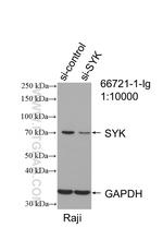 SYK Antibody in Western Blot (WB)