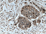 TYMS Antibody in Immunohistochemistry (Paraffin) (IHC (P))