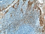 Cytokeratin 5 Antibody in Immunohistochemistry (Paraffin) (IHC (P))