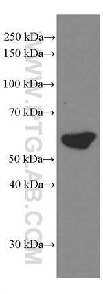 Cytokeratin 5 Antibody in Western Blot (WB)