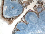 Cytokeratin 5 Antibody in Immunohistochemistry (Paraffin) (IHC (P))