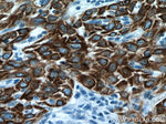 Cytokeratin 5 Antibody in Immunohistochemistry (Paraffin) (IHC (P))