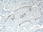 Cytokeratin 5 Antibody in Immunohistochemistry (Paraffin) (IHC (P))