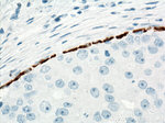 Cytokeratin 5 Antibody in Immunohistochemistry (Paraffin) (IHC (P))