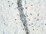 Cytokeratin 5 Antibody in Immunohistochemistry (Paraffin) (IHC (P))