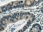 EPAS1 Antibody in Immunohistochemistry (Paraffin) (IHC (P))