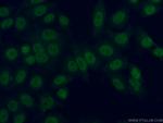 ARNT/HIF1B Antibody in Immunocytochemistry (ICC/IF)