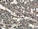 RHOA Antibody in Immunohistochemistry (Paraffin) (IHC (P))