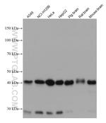 Dystroglycan Antibody in Western Blot (WB)