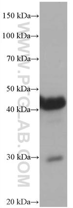 Dystroglycan Antibody in Western Blot (WB)