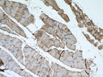 Dystroglycan Antibody in Immunohistochemistry (Paraffin) (IHC (P))