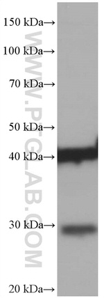 Dystroglycan Antibody in Western Blot (WB)