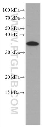 IL1 beta Antibody in Western Blot (WB)