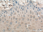 IL1 beta Antibody in Immunohistochemistry (Paraffin) (IHC (P))