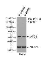 ATG5 Antibody in Western Blot (WB)