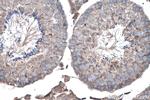 YTHDF1 Antibody in Immunohistochemistry (Paraffin) (IHC (P))